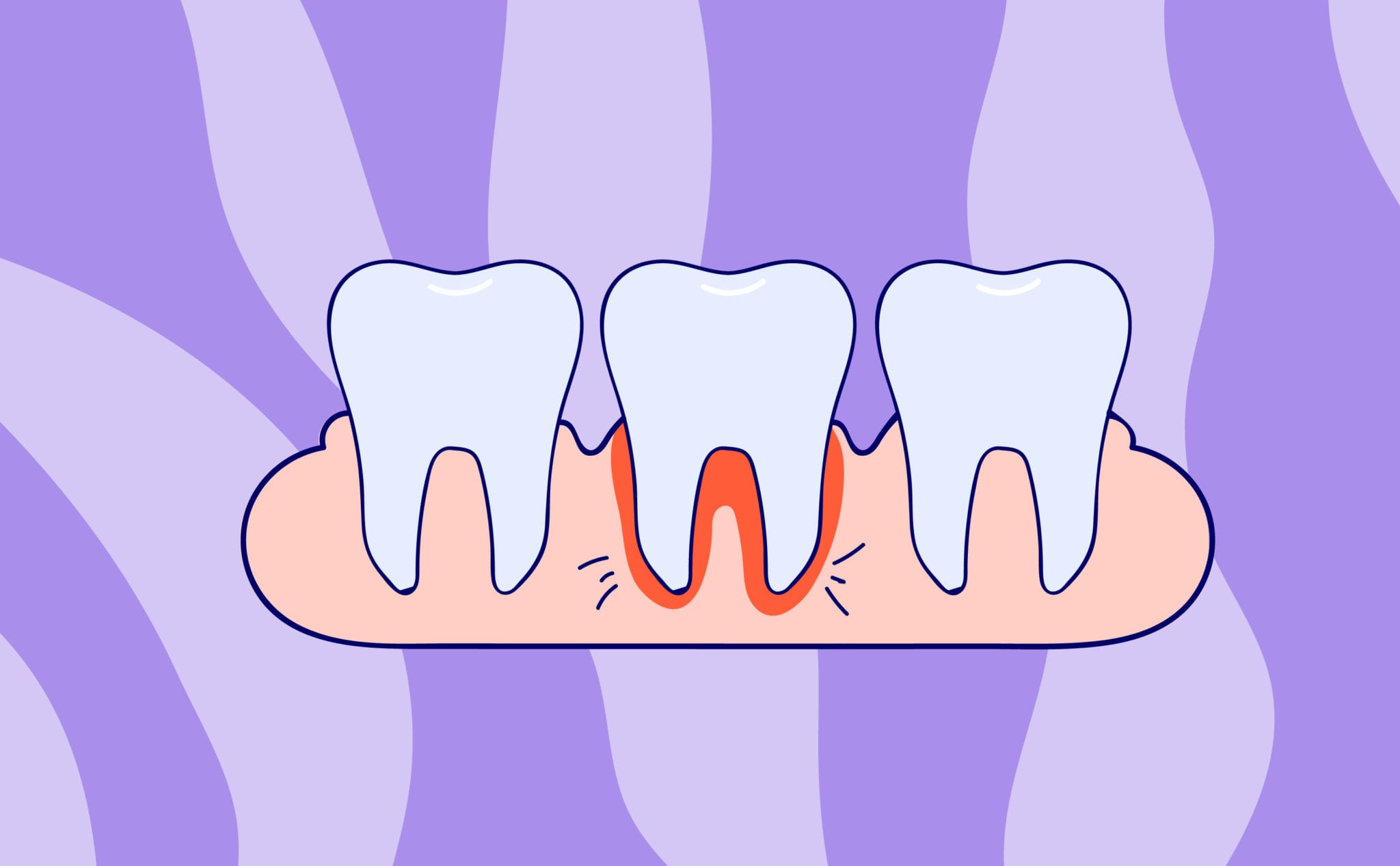 Information About Gum Problems and Menopause Elektra Health