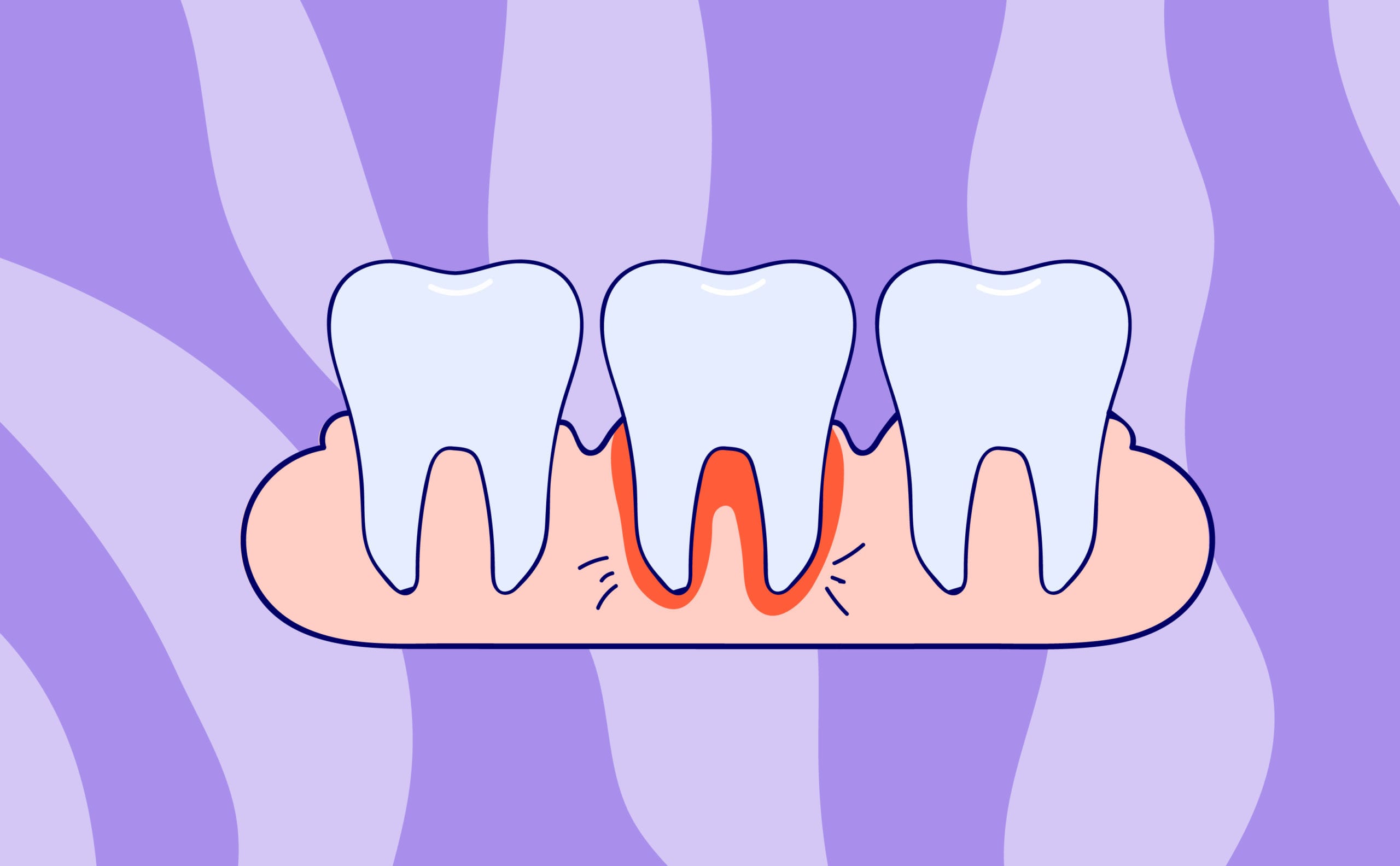 Information About Gum Problems and Menopause Elektra Health