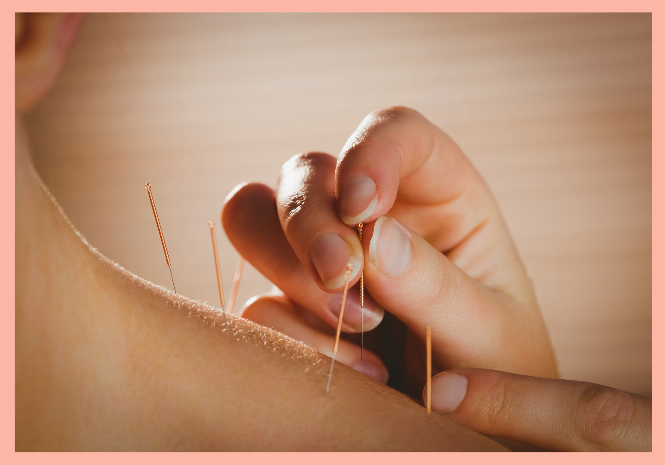 Can Acupuncture Help With Menopause Symptoms?