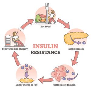 Graphic of Insulin resistance pathological health condition in educational outline diagram. Labeled cycle scheme with anatomical explanation of process vector illustration. Medical state with high food demand.